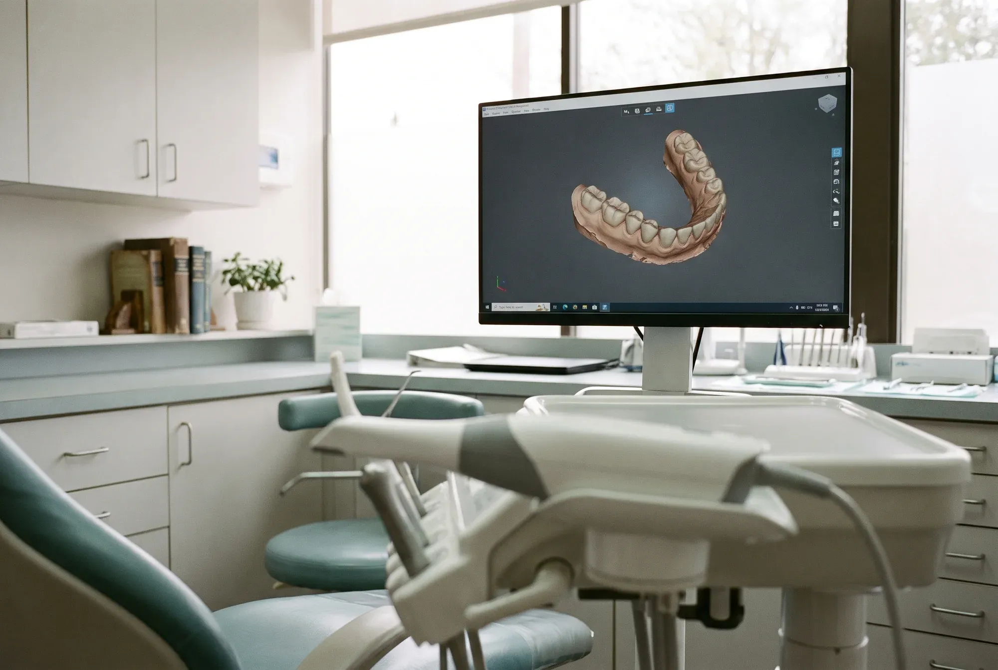 Intraoralni skener pored stomatološke stolice i monitor sa digitalnim 3D otiskom donje vilice